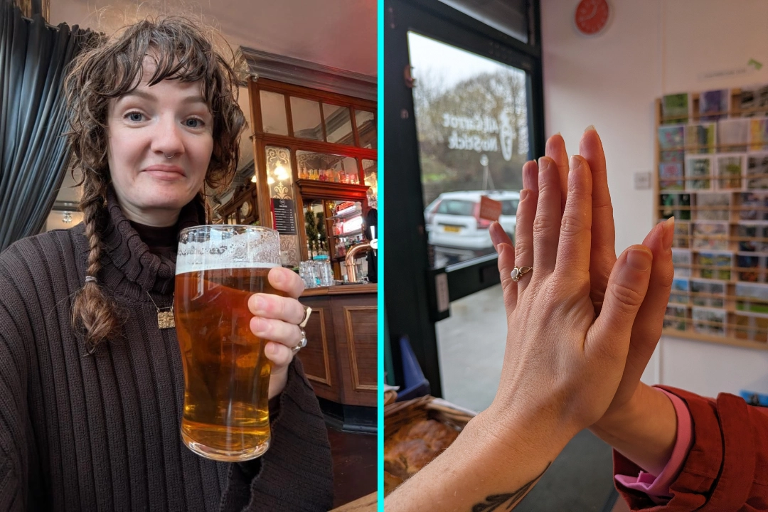 Woman, 30, with child-sized hands goes viral after revealing she can't hold pint glasses or carry rounds. She buys kids' gloves and struggles with jars and large items.