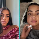 Mum left looking like Family Guy's Quagmire after wisdom teeth removal with no aftercare - Thalia George spent a week in hospital on the brink of sepsis after the surgery.