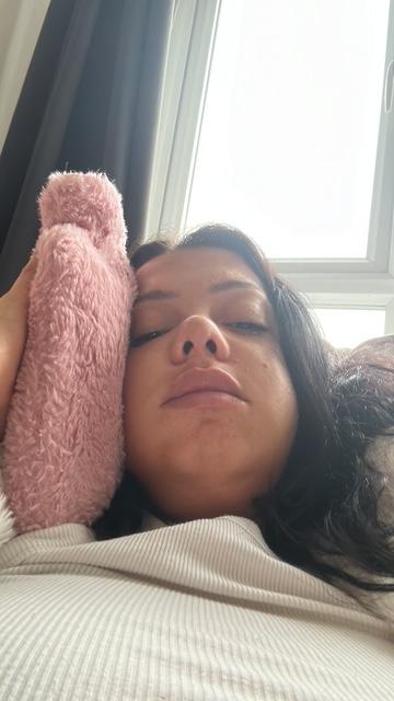 Mum left looking like Family Guy's Quagmire after wisdom teeth removal with no aftercare - Thalia George spent a week in hospital on the brink of sepsis after the surgery.