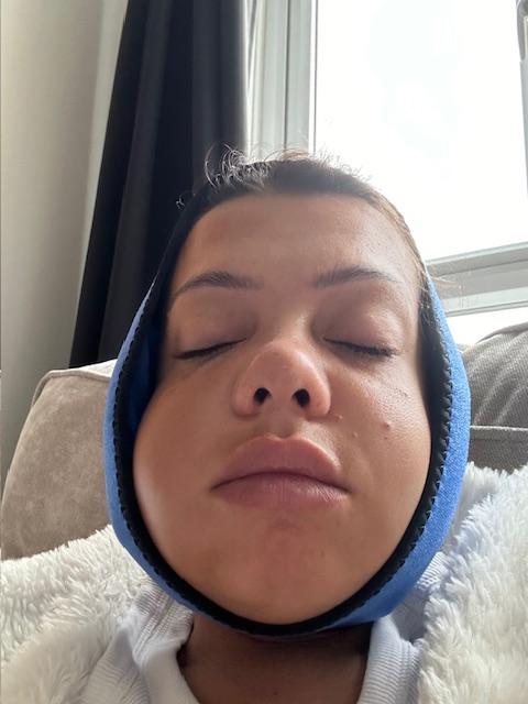 Mum left looking like Family Guy's Quagmire after wisdom teeth removal with no aftercare - Thalia George spent a week in hospital on the brink of sepsis after the surgery.