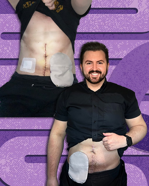 Brit abroad Luke Bennett was left stunned after discovering a dedicated stoma changing station at Alicante airport - calling it five steps ahead for people with hidden disabilities.