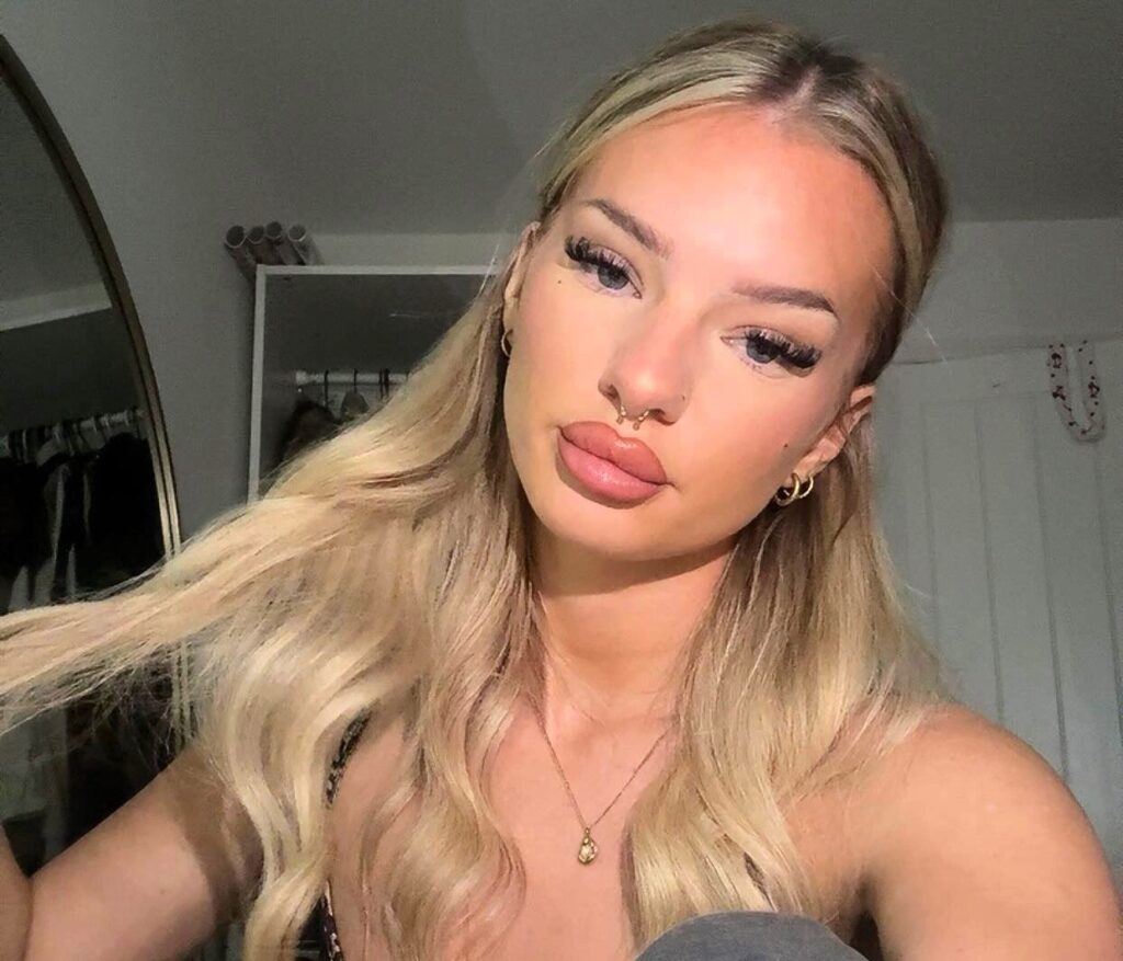 Mum Skye van Rensburg, 21, virtually deaf for six years after damaging ears with cotton buds - finally hears properly again after grim microsuction wax removal.