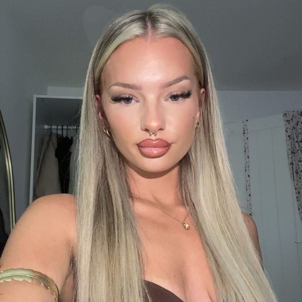 Mum Skye van Rensburg, 21, virtually deaf for six years after damaging ears with cotton buds - finally hears properly again after grim microsuction wax removal.