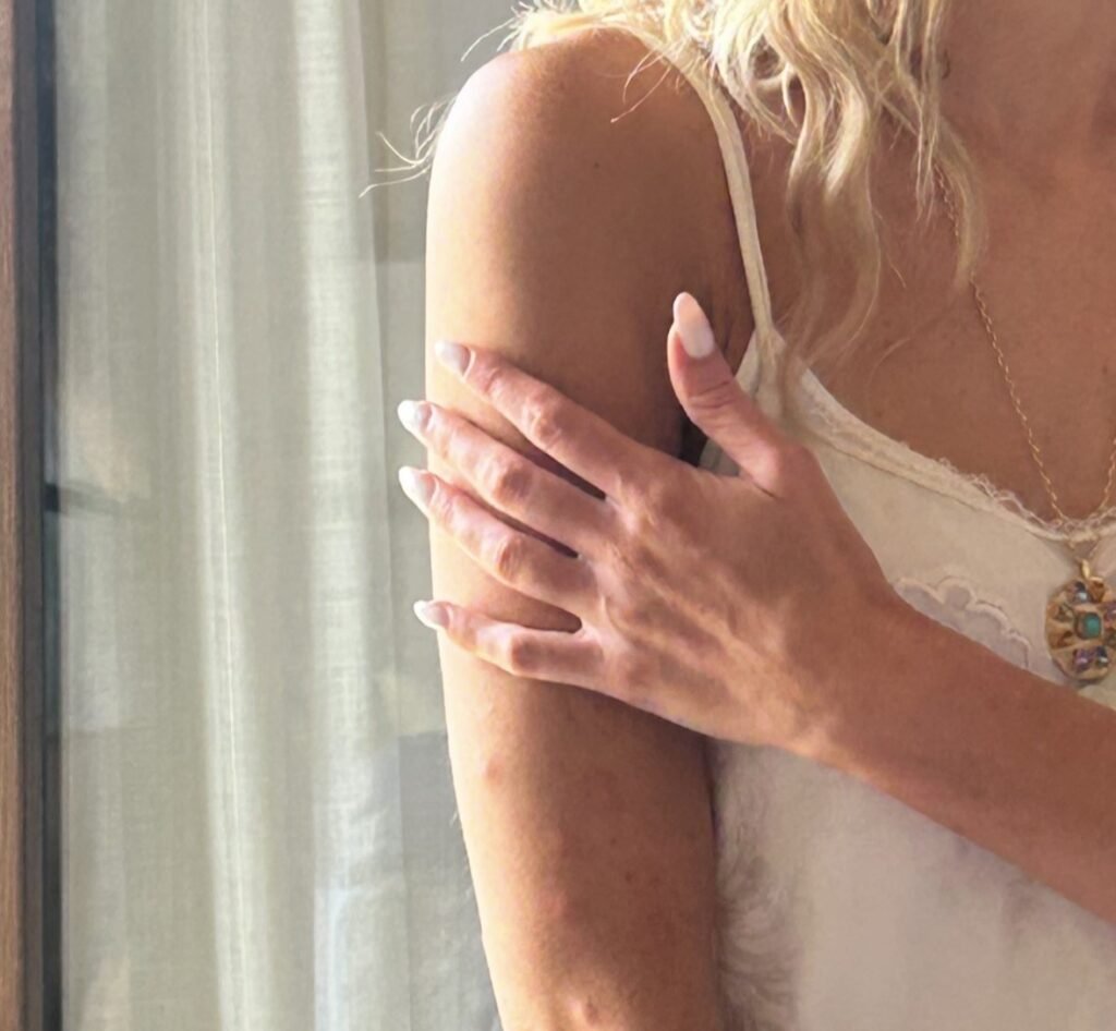 Bride woke up covered in more than 50 swollen mosquito bites on her wedding day after sleeping with the doors open when the air conditioning broke at her Mallorca accommodation.