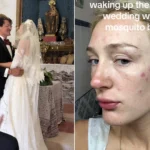 Bride woke up covered in more than 50 swollen mosquito bites on her wedding day after sleeping with the doors open when the air conditioning broke at her Mallorca accommodation.