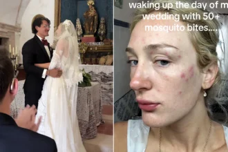 Bride woke up covered in more than 50 swollen mosquito bites on her wedding day after sleeping with the doors open when the air conditioning broke at her Mallorca accommodation.