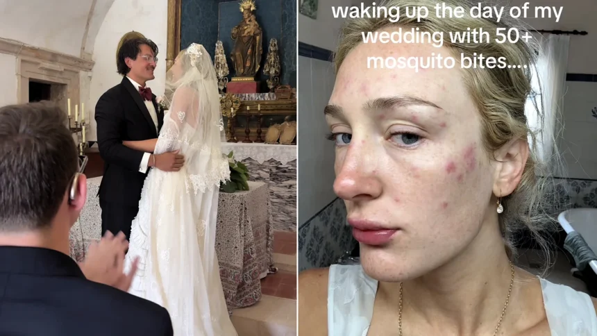 Bride woke up covered in more than 50 swollen mosquito bites on her wedding day after sleeping with the doors open when the air conditioning broke at her Mallorca accommodation.