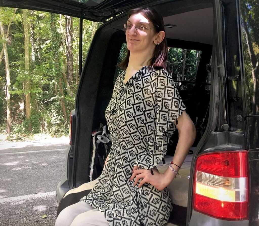 World's tallest woman told her lifelong diagnosis was wrong at 29 - she is now one of just six known cases of a mystery condition with no known cause.
