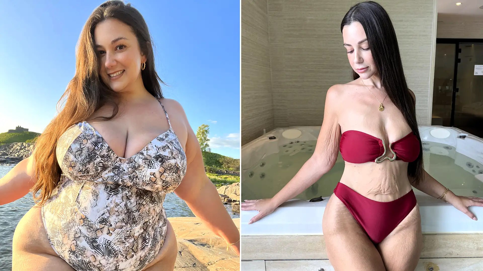 ‘I built a platform on body positivity – then I had surgery'