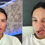 A woman woke to find her lip had ballooned after she chewed it in her sleep, leaving her looking "like she'd been stung by a bee" - just hours before a visa run.