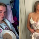 A woman was left fighting for her life with sepsis after shaving her bikini line - an ingrown hair swelled into a rock-hard lump the size of a big phone.