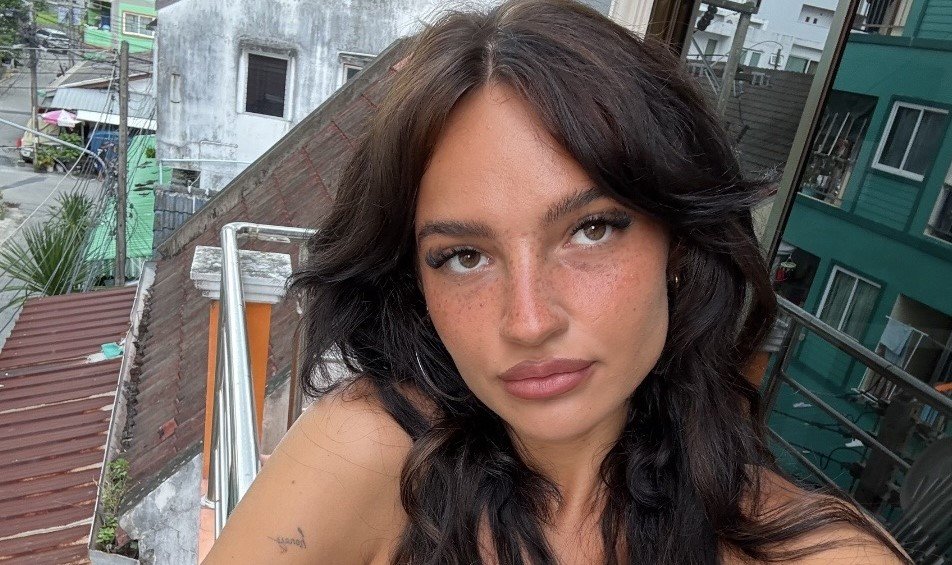 A woman woke to find her lip had ballooned after she chewed it in her sleep, leaving her looking "like she'd been stung by a bee" - just hours before a visa run.
