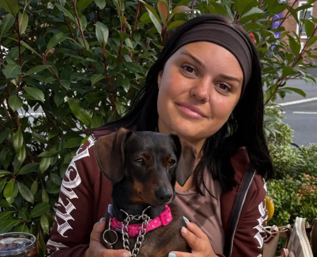 Woman wakes up with a rare Geordie accent after migraine and says she never wants her original voice back three years later - shocking transformation.
