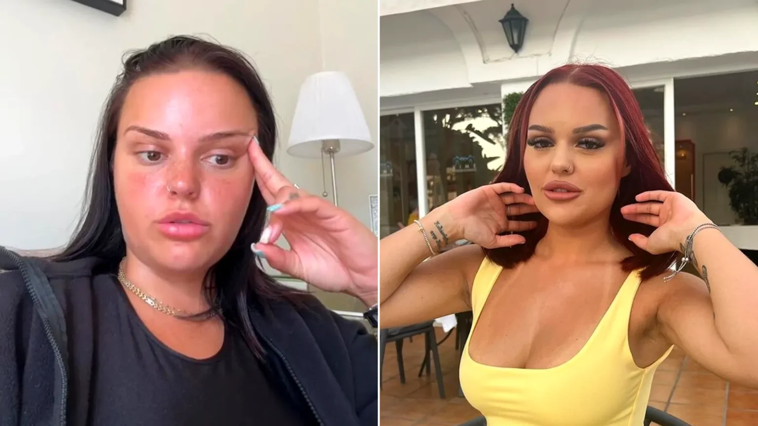 Woman wakes up with a rare Geordie accent after migraine and says she never wants her original voice back three years later - shocking transformation.