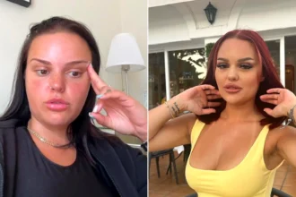 Woman wakes up with a rare Geordie accent after migraine and says she never wants her original voice back three years later - shocking transformation.